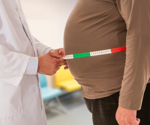Obesity-Weight-Management-img